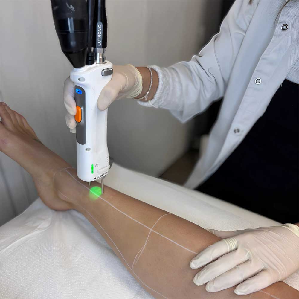 Epilation laser au Centre Victoire Haussmann à Paris