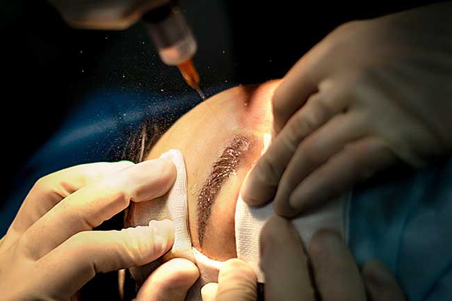 Greffer des sourcils au Centre Victoire Haussmann